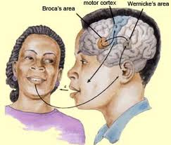 afasia Broca e Wernicke